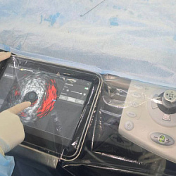 Увидеть невидимое: точность, которая спасает жизни